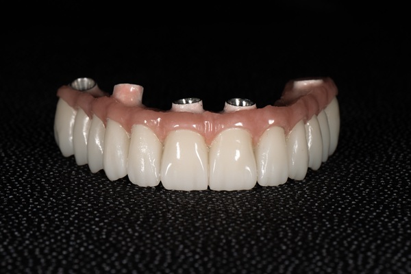 Ways You Can Keep Your Implant Supported Dentures Clean And Functional