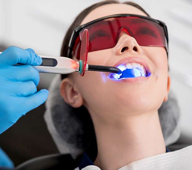 Dickson Professional Teeth Whitening