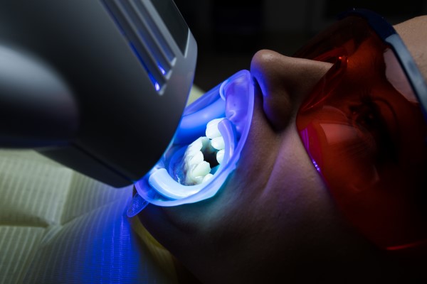 Am I A Candidate For Teeth Whitening If I Have Sensitive Teeth?