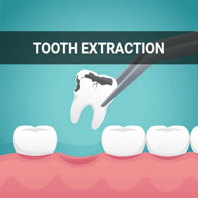 Visit our Tooth Extraction page